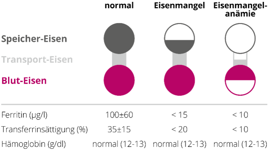 Wie wird ein Eisen 173 mangel festgestellt 